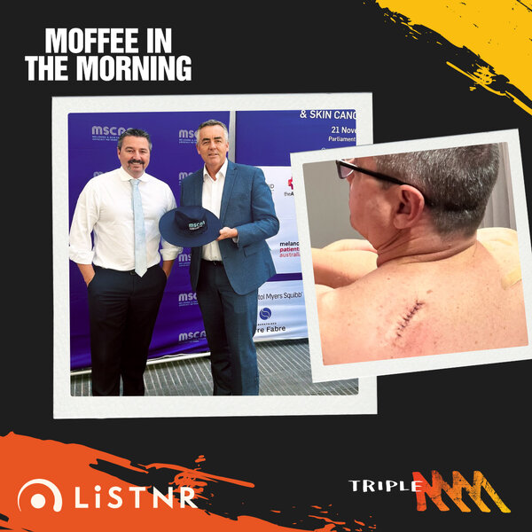 Pat Conaghan Talks About Melanoma - Moffee In The Morning - Triple M ...