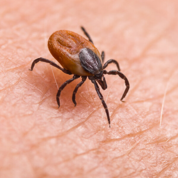 Tick Borne Disease Known As Babesiosis Is On The Rise In Us Wcbsam